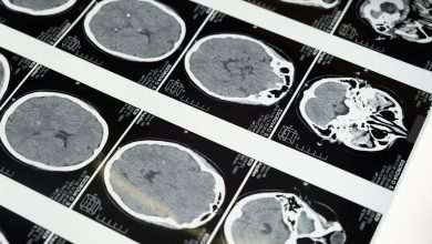 How Does TMS For Anxiety Work? Everything You Need To Know